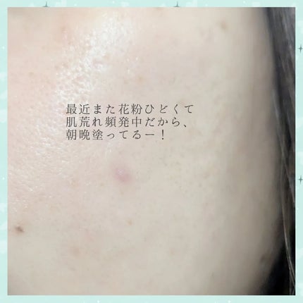 シカスポットクリーム/NATURAL DERMA PROJECT/フェイスクリームを使ったクチコミ(3枚目)