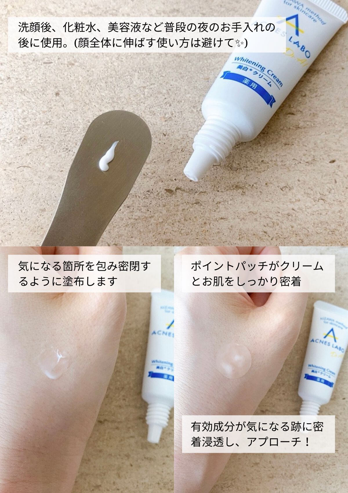 薬用 美白アクネホワイトクリーム 専用パッチ付/アクネスラボ/その他キットセットを使ったクチコミ（3枚目）