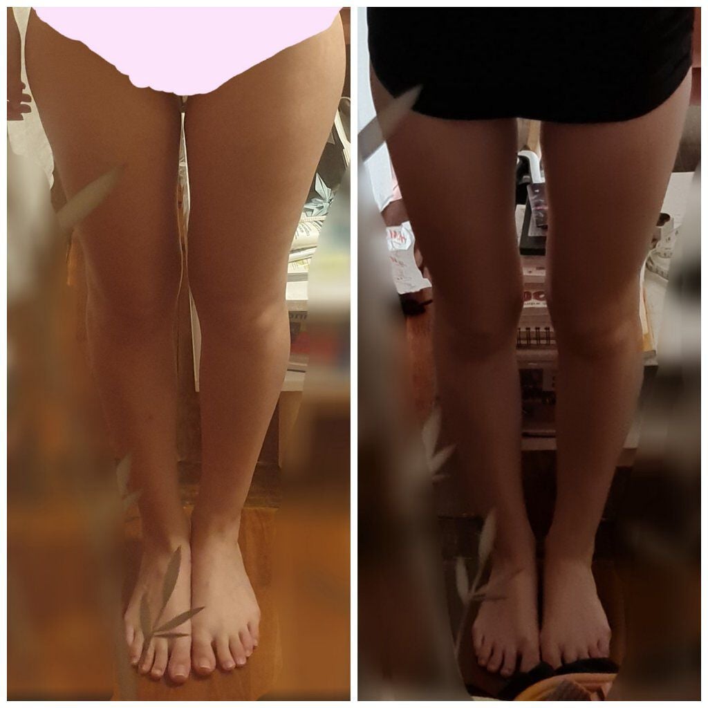 twinkle_blush_qkf on LIPS 「7月に57キロだった今は48キロ朝ごはんは食べないたまに昼御飯..」(1枚目)