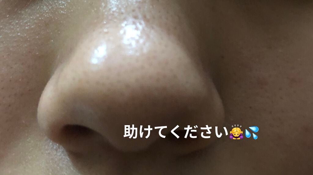 て on LIPS 「【毛穴に悩んでいます】助けてください💦💦💦今高校生で毛穴にずっ..」(1枚目)
