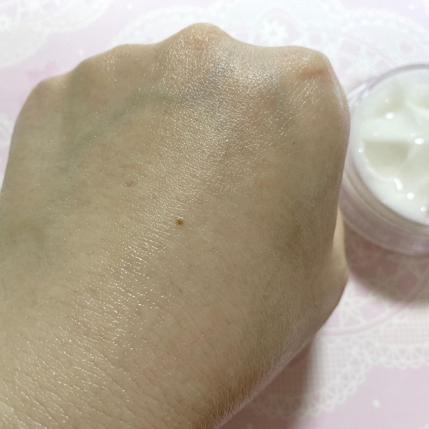 ããã¿ðãã©ãã100 on LIPS ãNMN+AGPowerRichCreamNMNÃãªããœãŒã åã..ãïŒ3æç®ïŒ