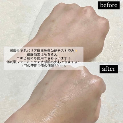 サミュ PHセンシティブクリーム/SAM'U/フェイスクリームを使ったクチコミ(5枚目)