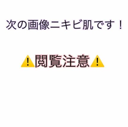 薬用クリーム洗顔/メンソレータム アクネス/洗顔フォームを使ったクチコミ(2枚目)