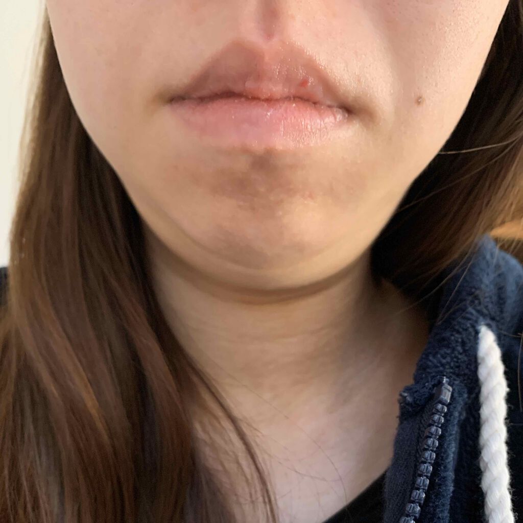 リップケア クリーム/キュレル/リップクリームを使ったクチコミ(2枚目)