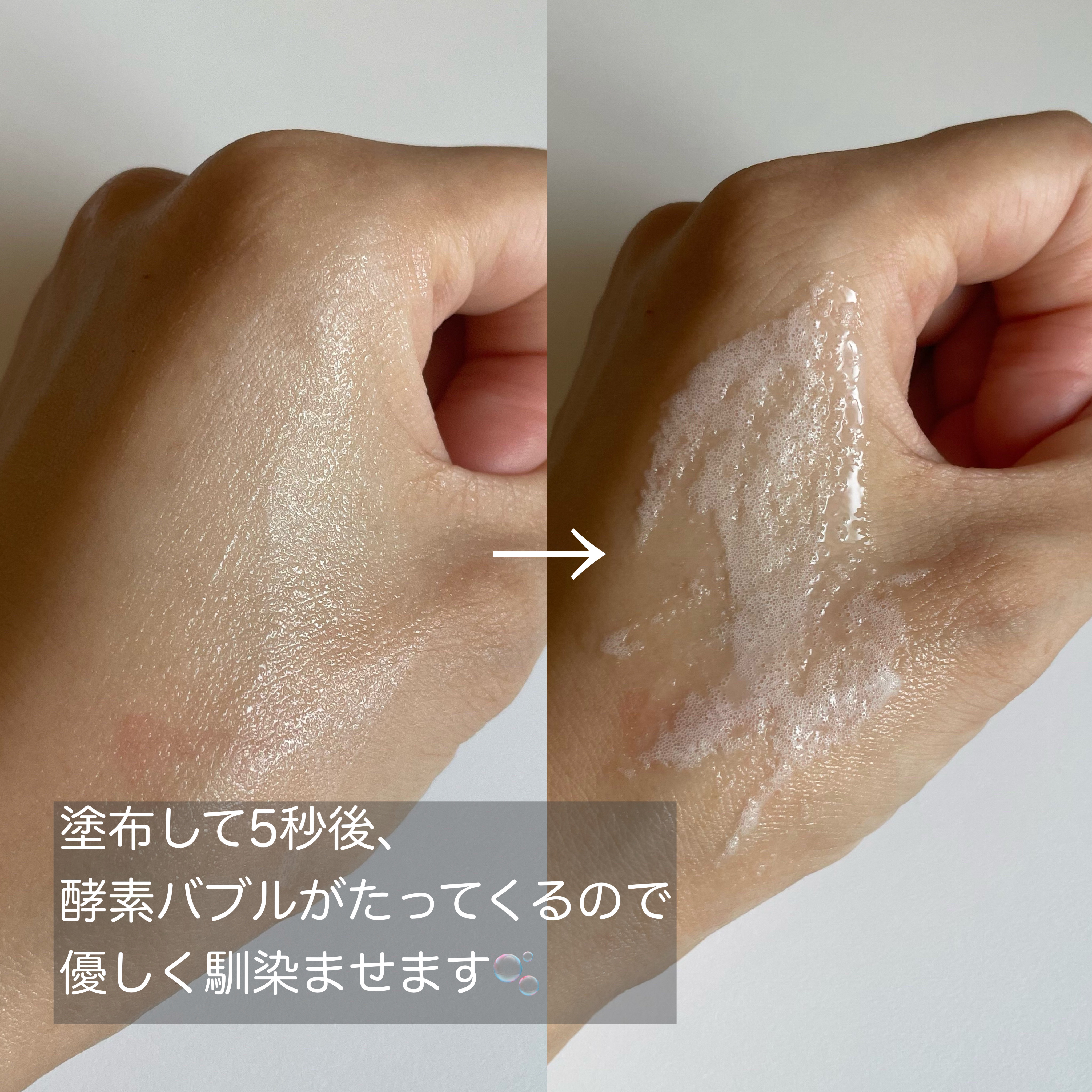 ペプチド ボリューム リフティングプロエッセンス/DR.PEPTI/美容液を使ったクチコミ（3枚目）