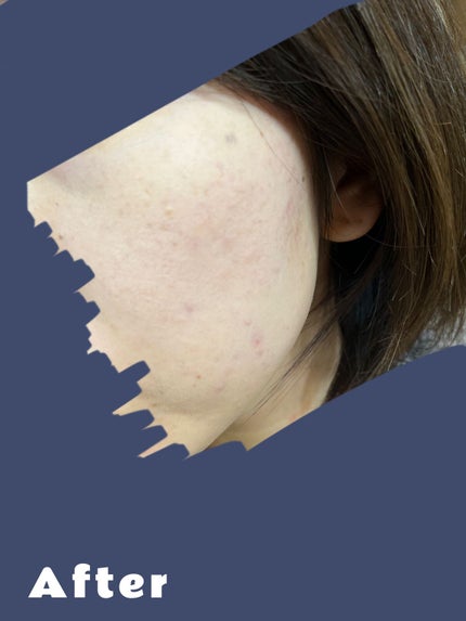 ベアプロ 16HR パウダー ファンデーション/bareMinerals/パウダーファンデーションを使ったクチコミ(3枚目)