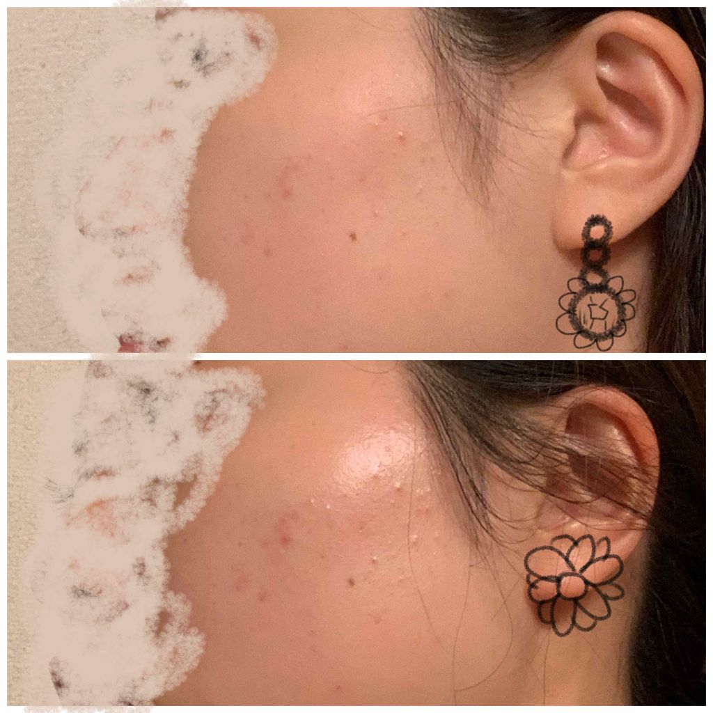 シリコーン潤マスク 3D/DAISO/その他スキンケアグッズを使ったクチコミ（2枚目）