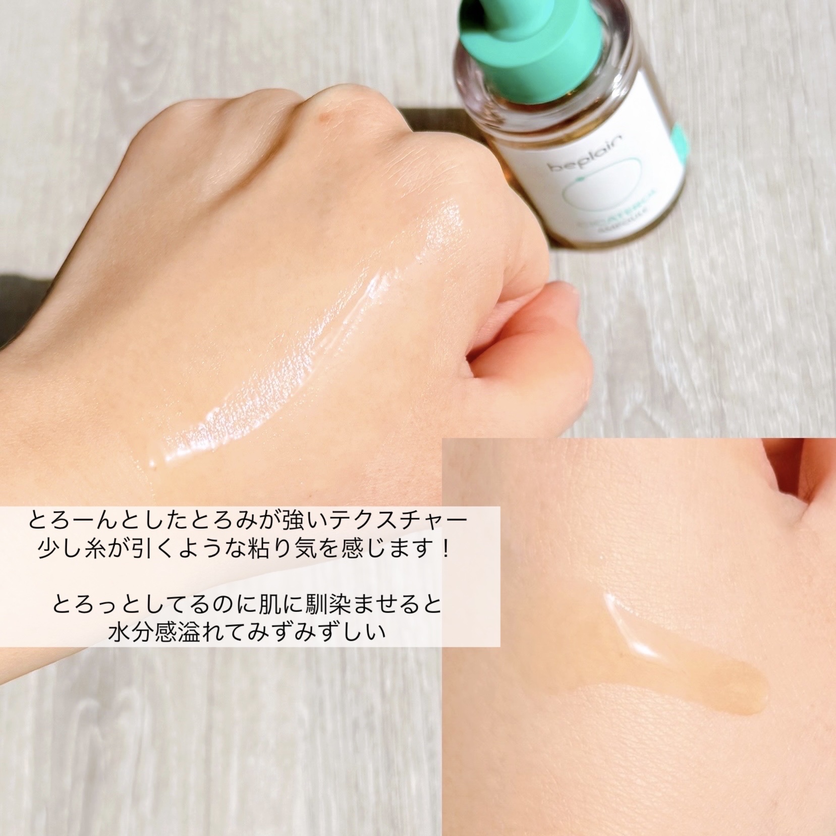 シカテロル美容液/beplain/美容液を使ったクチコミ（1枚目）