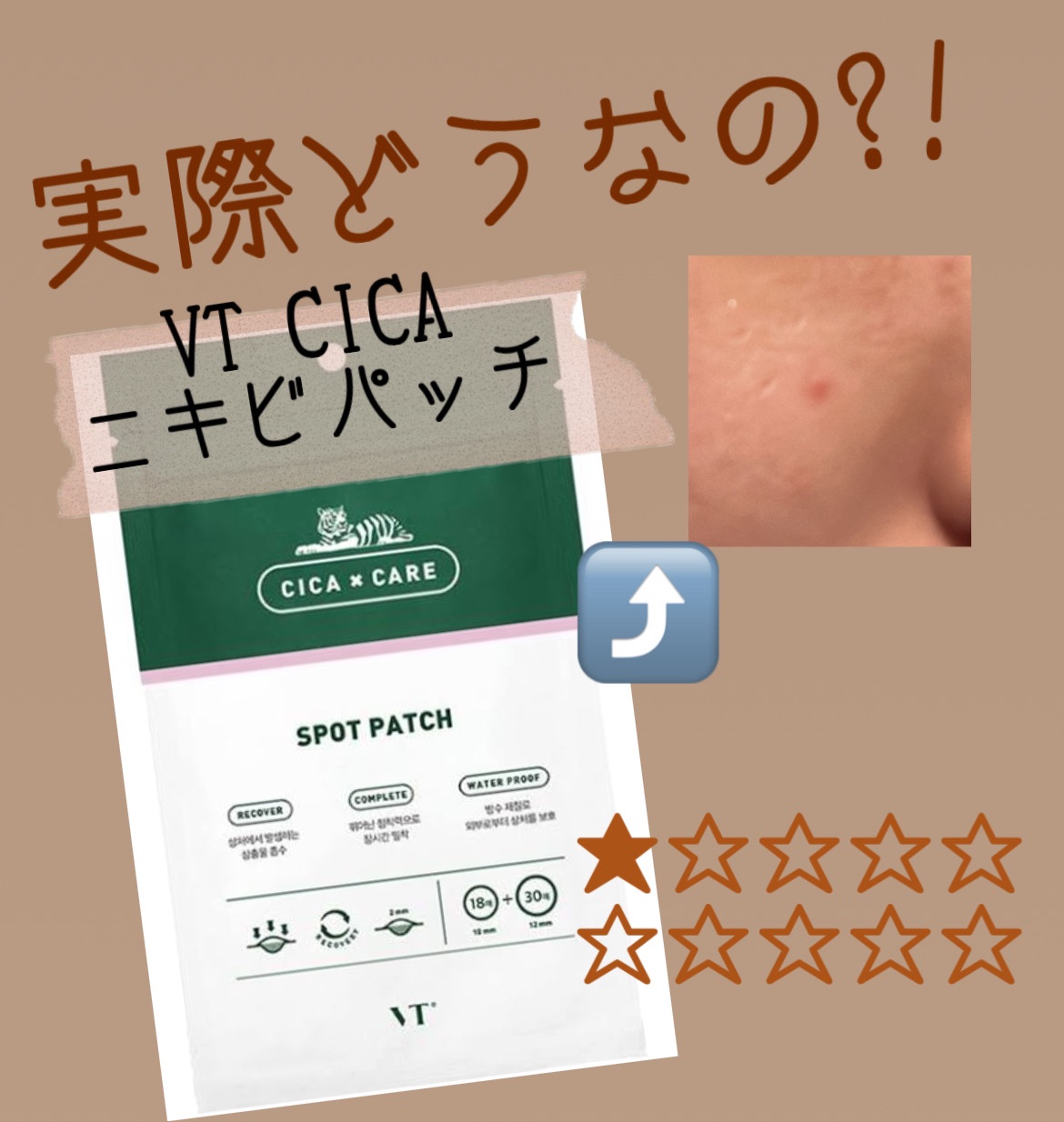 プロCICA クリアスポットパッチ/VT/その他スキンケアを使ったクチコミ（1枚目）