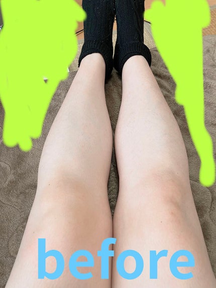 RFボーテ キャビスパRFコア/YA-MAN TOKYO JAPAN/ボディケア美容家電を使ったクチコミ(1枚目)