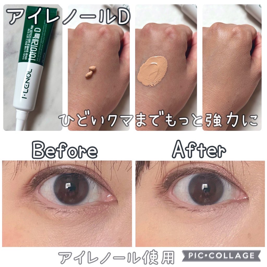 アイレノール クマクリーム/IRENOL/アイケア・アイクリームを使ったクチコミ（3枚目）