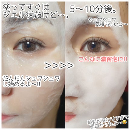 バブリングジェル/roseach/その他スキンケアを使ったクチコミ(4枚目)