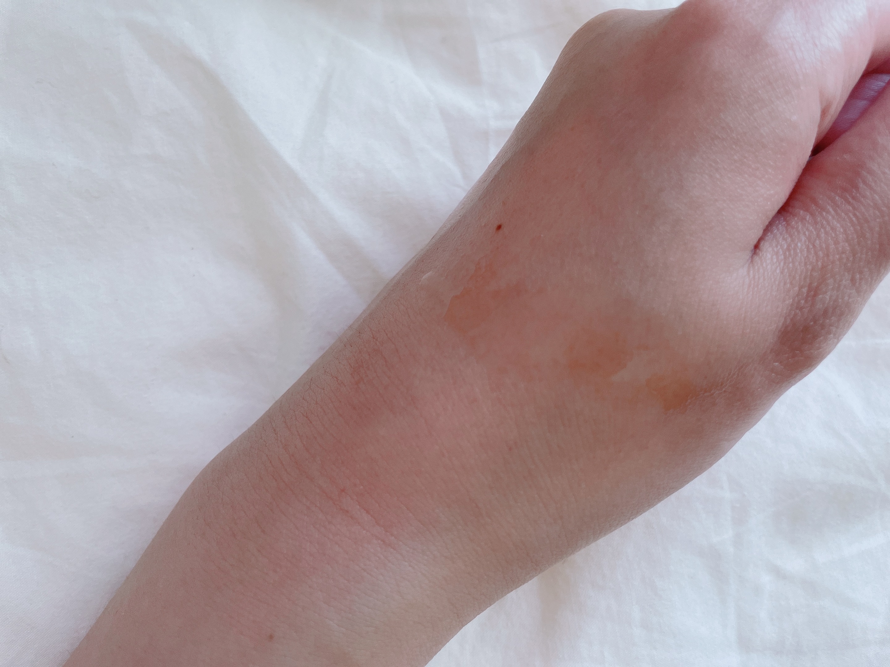 ナイアシンアミドブレミッシュケアセラム/ONE THING/美容液を使ったクチコミ（2枚目）