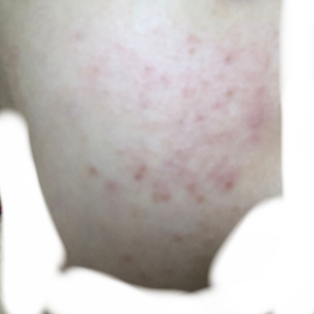 なな on LIPS 「皆さんお久しぶりです!肌断食をして何日ぶりでしょう…肌断食をし..」(2枚目)