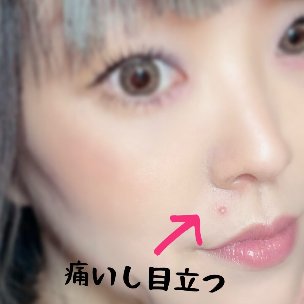 プロCICA クリアスポットパッチ/VT/その他スキンケアを使ったクチコミ（3枚目）