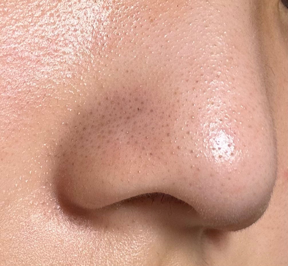 よんちょる on LIPS 「割とガチめに助けてください。最近スキンケアとかサボってたりして..」(4枚目)