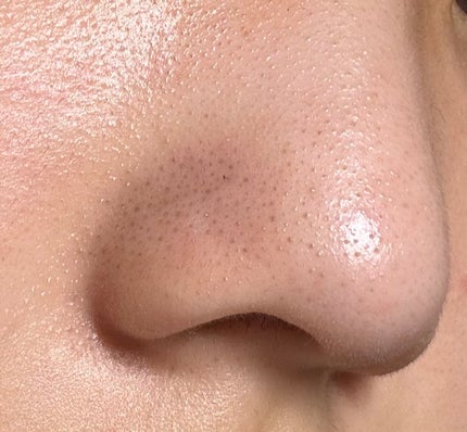 よんちょる on LIPS 「割とガチめに助けてください。最近スキンケアとかサボってたりして..」(4枚目)