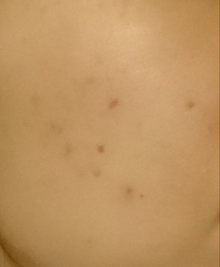 ネイチャーコンク 薬用クリアローション/ネイチャーコンク/拭き取り化粧水を使ったクチコミ(3枚目)