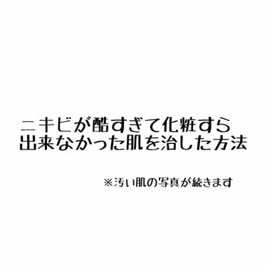 ツムギです ◎

新着投稿から見ていただいている方、検索に引っかかってこの投稿を見ていただいている方、ありがとうございます◎

化粧すら出来ないぐらい肌荒れがピークだった時から落ち着くまでのお話をしたい