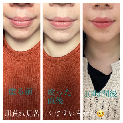 エアブラシ フローレス ファンデーション/Charlotte Tilbury/リキッドファンデーションを使ったクチコミ(2枚目)