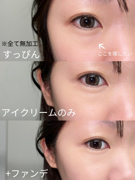 アイレノール クマクリーム/IRENOL/アイケア・アイクリームを使ったクチコミ(2枚目)