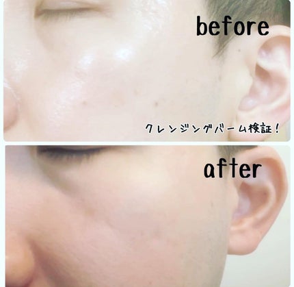 シカマイルドクレンジングバーム/VT/クレンジングバームを使ったクチコミ(6枚目)