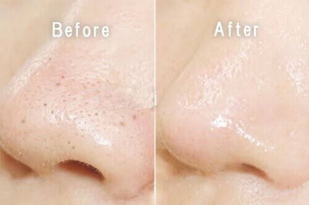 デュオ ザ クレンジングバーム/DUO/クレンジングバームを使ったクチコミ（2枚目）