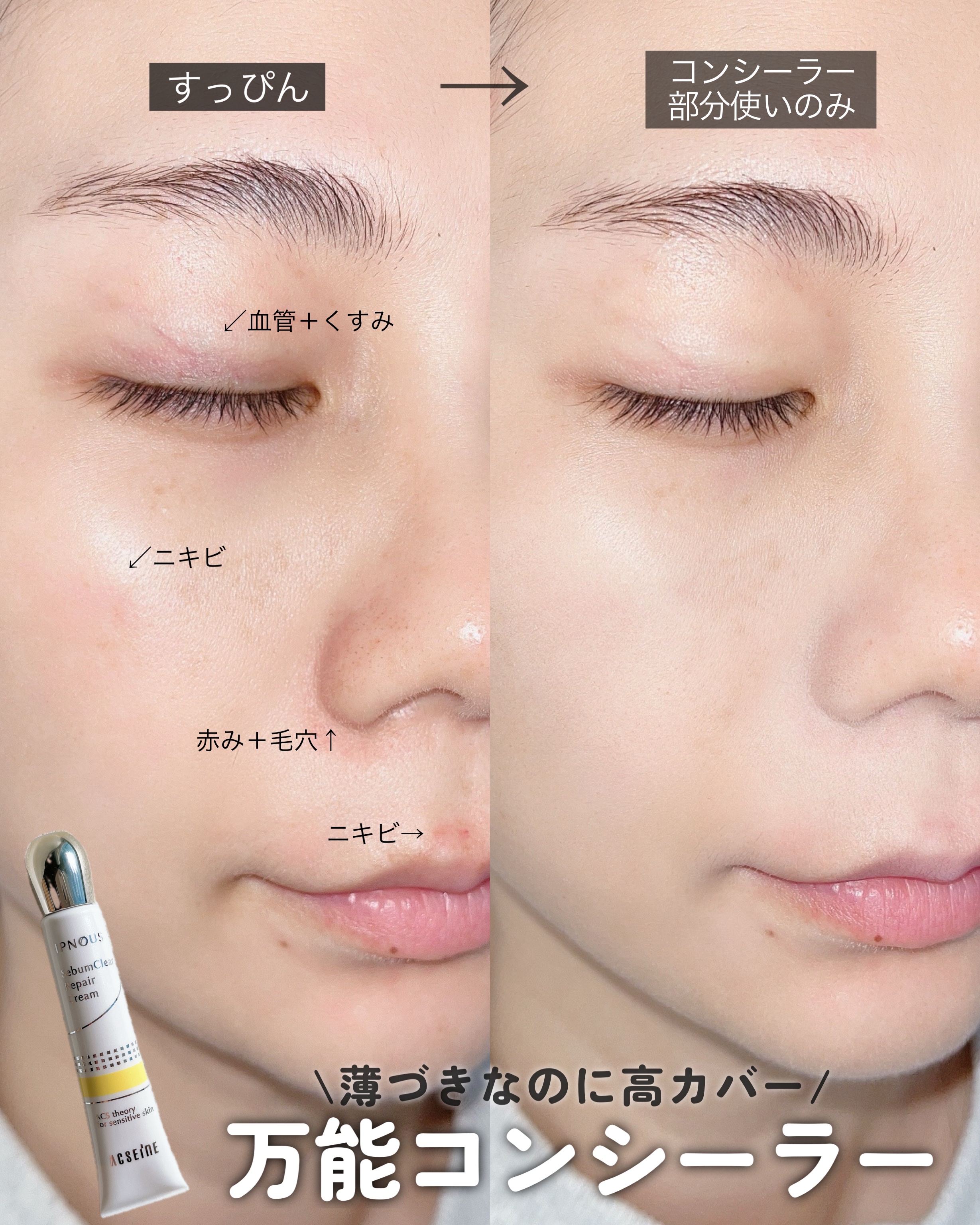 イプノス シーバムクリア リペアクリーム/ACSEINE/フェイスクリームを使ったクチコミ（1枚目）