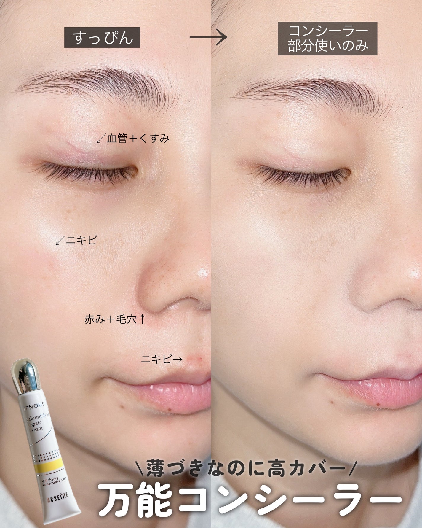 イプノス シーバムクリア リペアクリーム/ACSEINE/フェイスクリームを使ったクチコミ(1枚目)