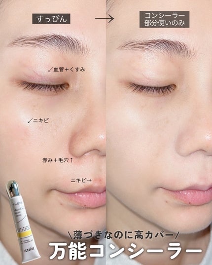 イプノス シーバムクリア リペアクリーム/ACSEINE/フェイスクリームを使ったクチコミ(1枚目)