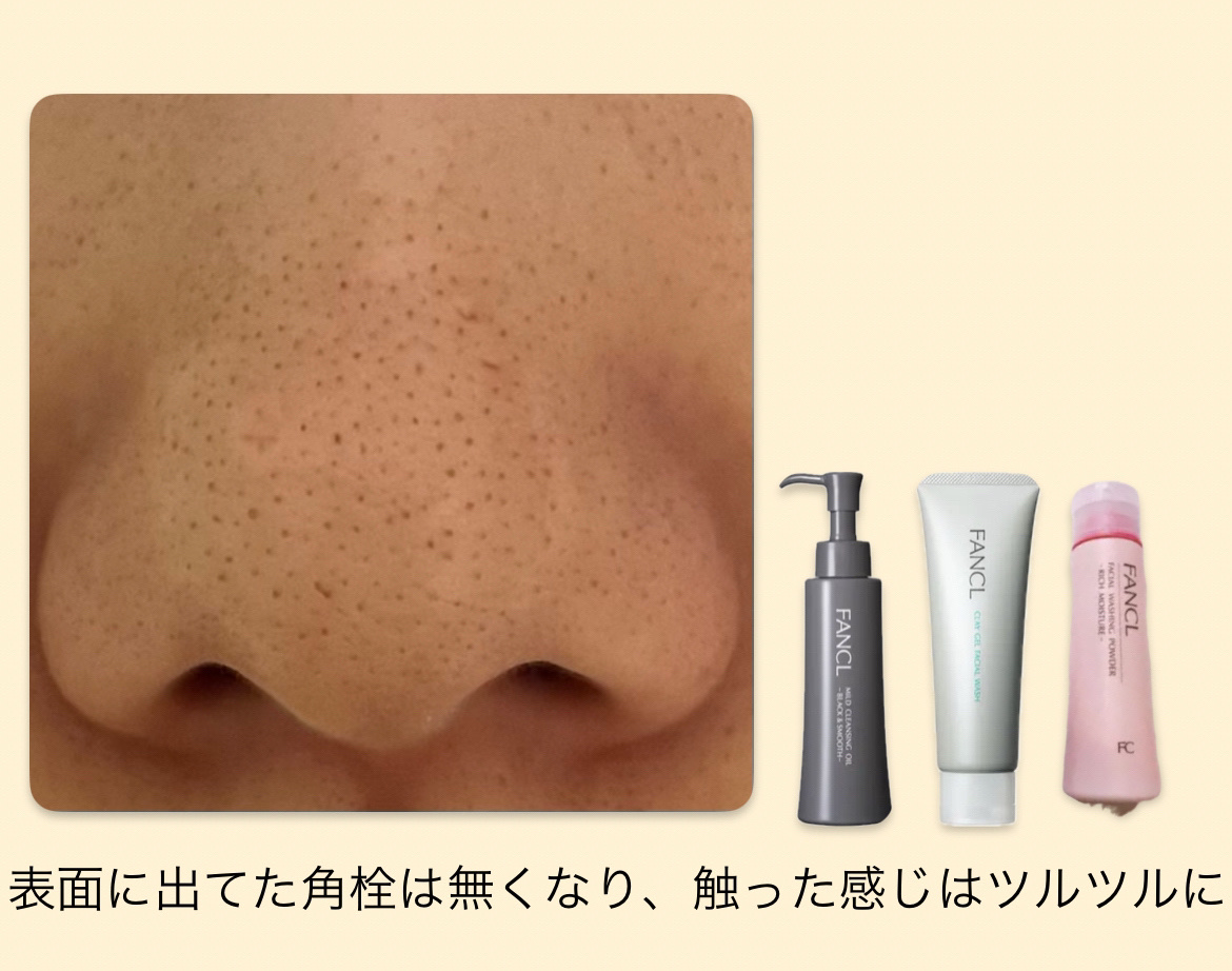 パーフェクトホイップu/SENKA（専科）/洗顔フォームを使ったクチコミ（2枚目）