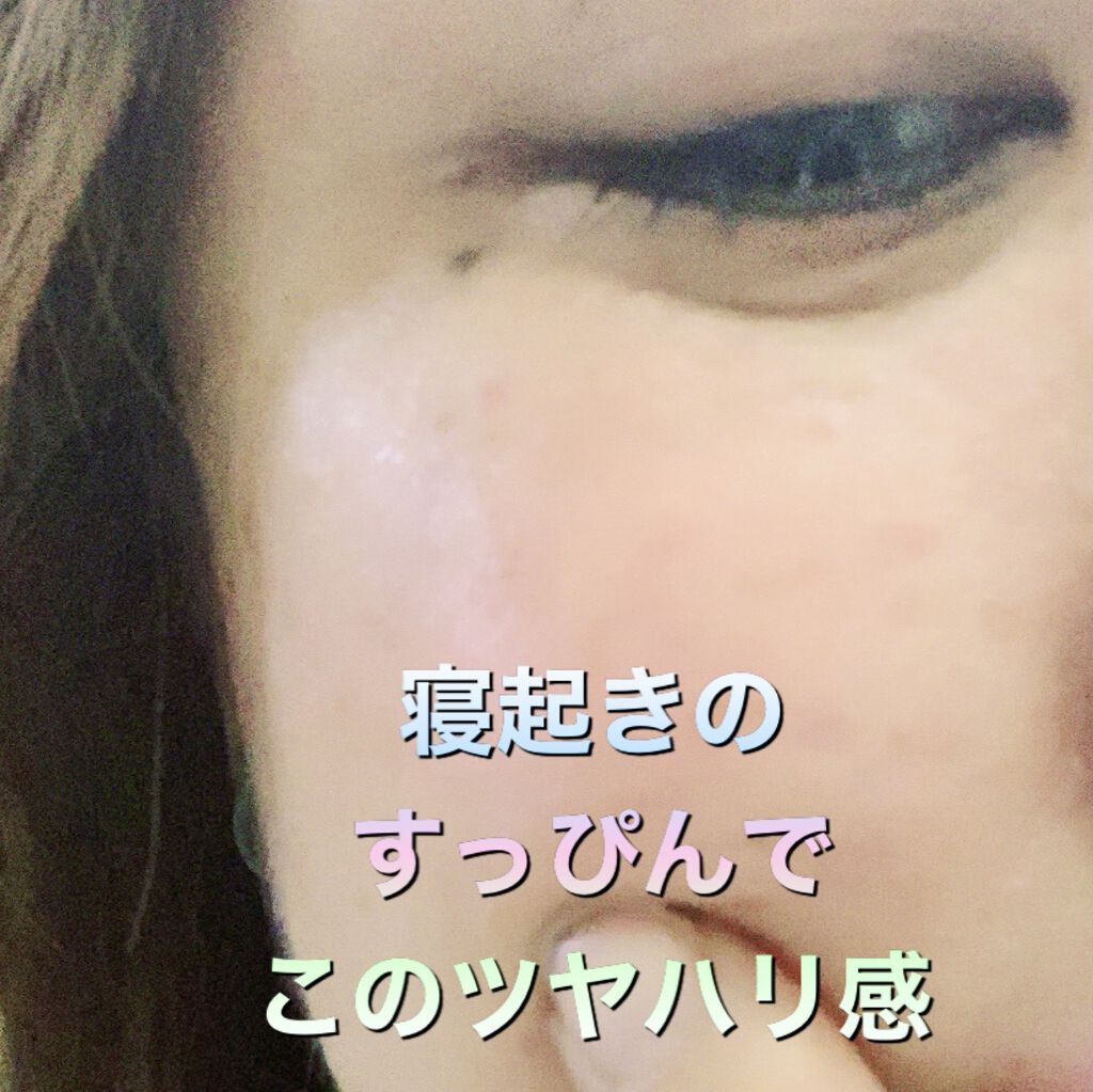 ベーシックトライアルキット/アスタリフト/トライアルキットを使ったクチコミ（1枚目）