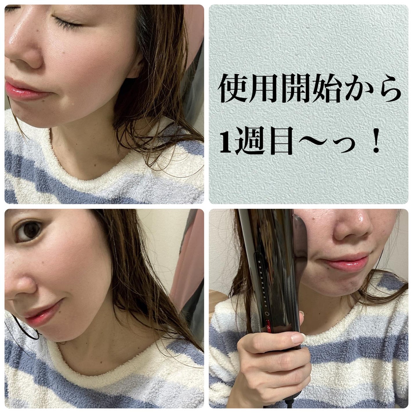 MiRAY/MYTREX/美顔器・マッサージを使ったクチコミ(3枚目)