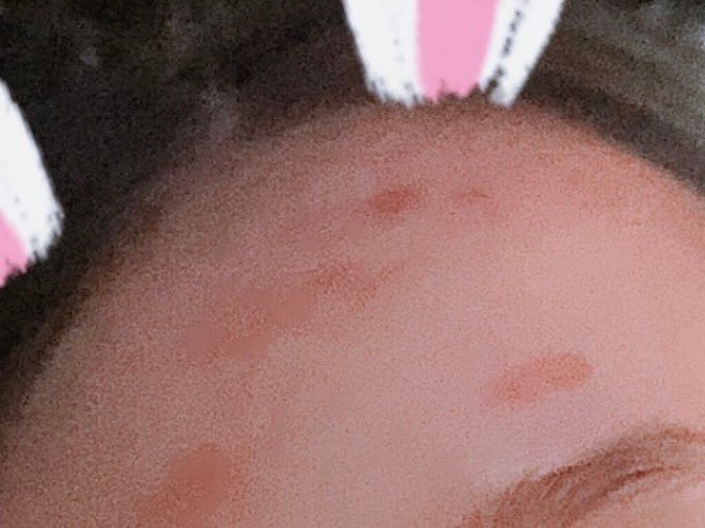 ダイソーパック/DAISO/シートマスク・パックを使ったクチコミ(3枚目)