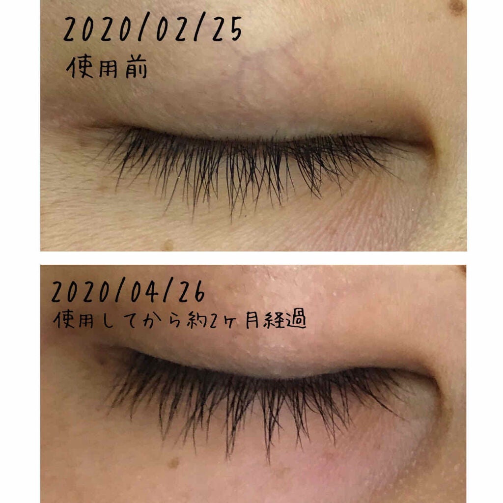 EMAKED(エマーキット)/水橋保寿堂製薬/まつげ美容液を使ったクチコミ(2枚目)