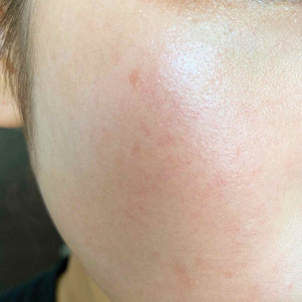 24 ミネラルモイストスティックファンデ/24h cosme/その他ファンデーションを使ったクチコミ(4枚目)