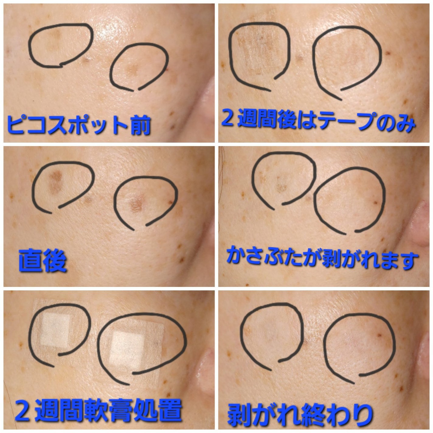 VC100エッセンスローション EX/ドクターシーラボⓇ/化粧水を使ったクチコミ(3枚目)