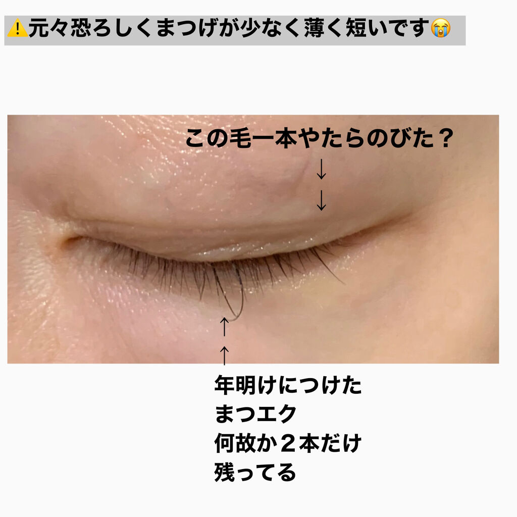 スカルプD ボーテ ピュアフリーアイラッシュセラム　プレミアム/アンファー(スカルプD)/まつげ美容液を使ったクチコミ（2枚目）