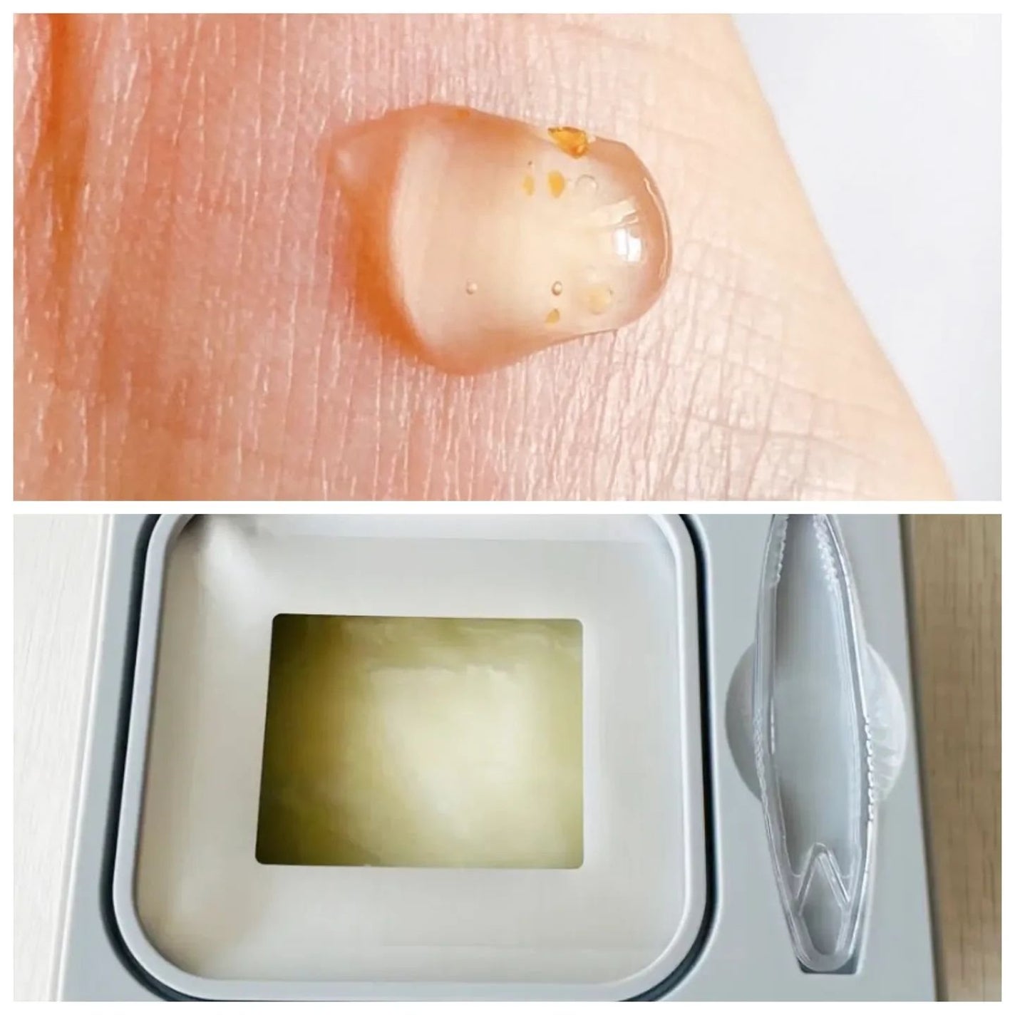 S100 ビタライトリードル/VT/美容液を使ったクチコミ(3枚目)