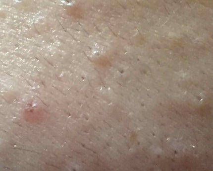 RIð°â€ïžðŠ on LIPS ãHelloRIã§ãïŒå©ããŠãã ãããããã倧éçºçäžã§ãðé ¬ã..ãïŒ4æç®ïŒ