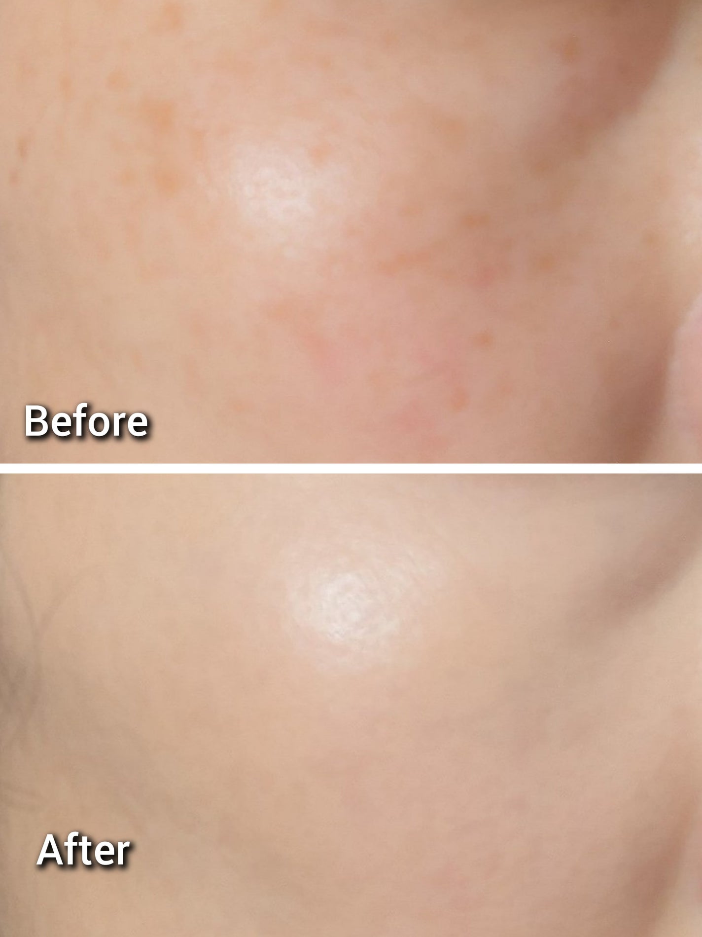 TIMAGE クリーミーコンシーラーパレット/TIMAGE/パレットコンシーラーを使ったクチコミ(9枚目)