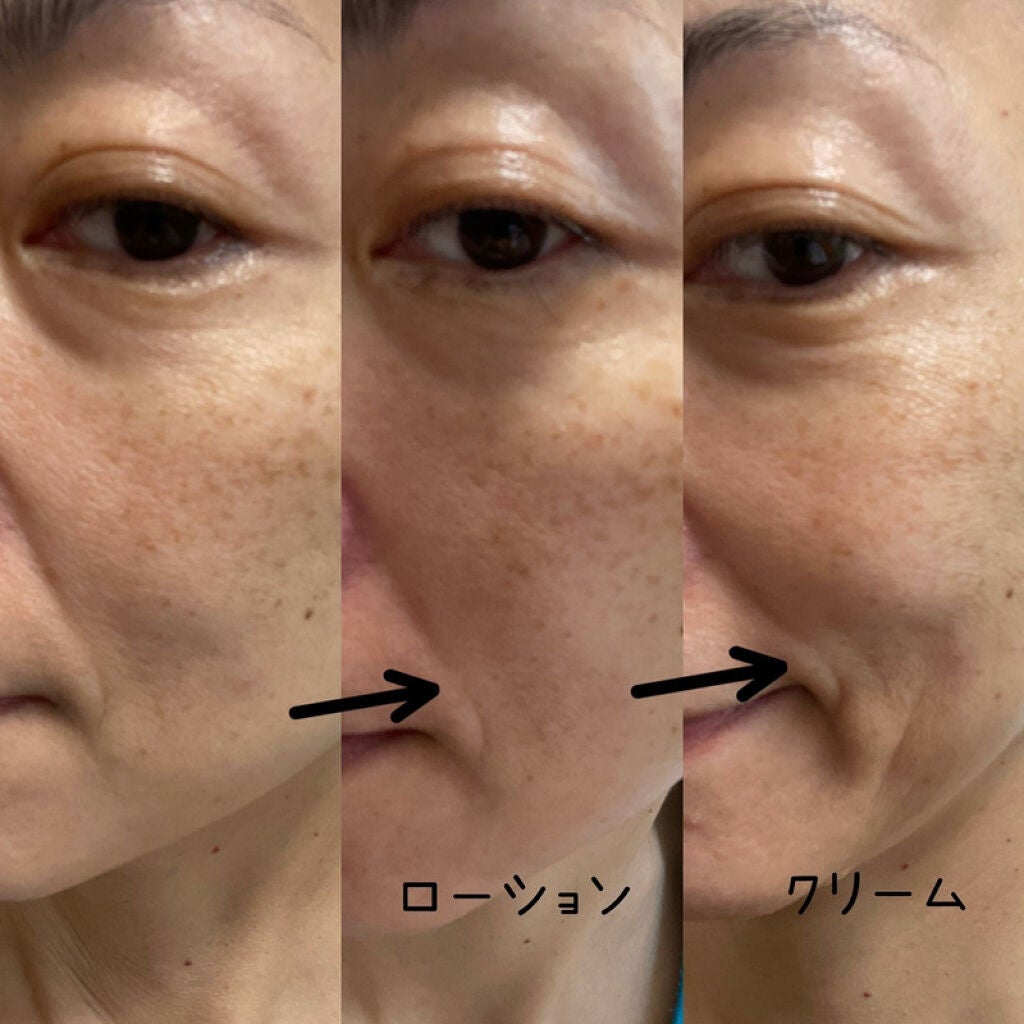 モイスチュアチャージローション/MUNOAGE(ミューノアージュ)/化粧水を使ったクチコミ(4枚目)