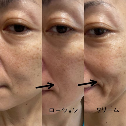 モイスチュアチャージローション/MUNOAGE(ミューノアージュ)/化粧水を使ったクチコミ(4枚目)