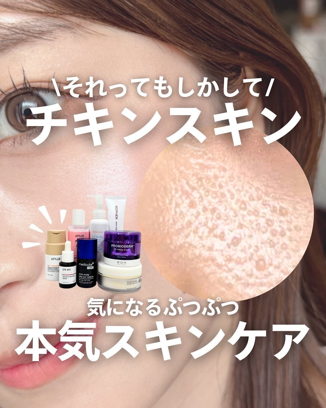 ナラ|毛穴ケアオタク🍓 on LIPS 「・・こんばんは、ナラです🙋♀️みんな最近SNSでよく聞く「チ..」(1枚目)