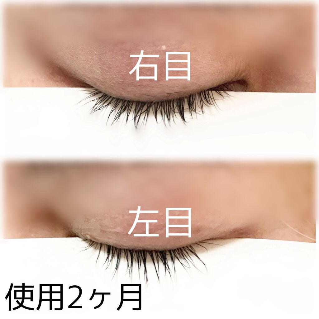 EMAKED(エマーキット)/水橋保寿堂製薬/まつげ美容液を使ったクチコミ(4枚目)