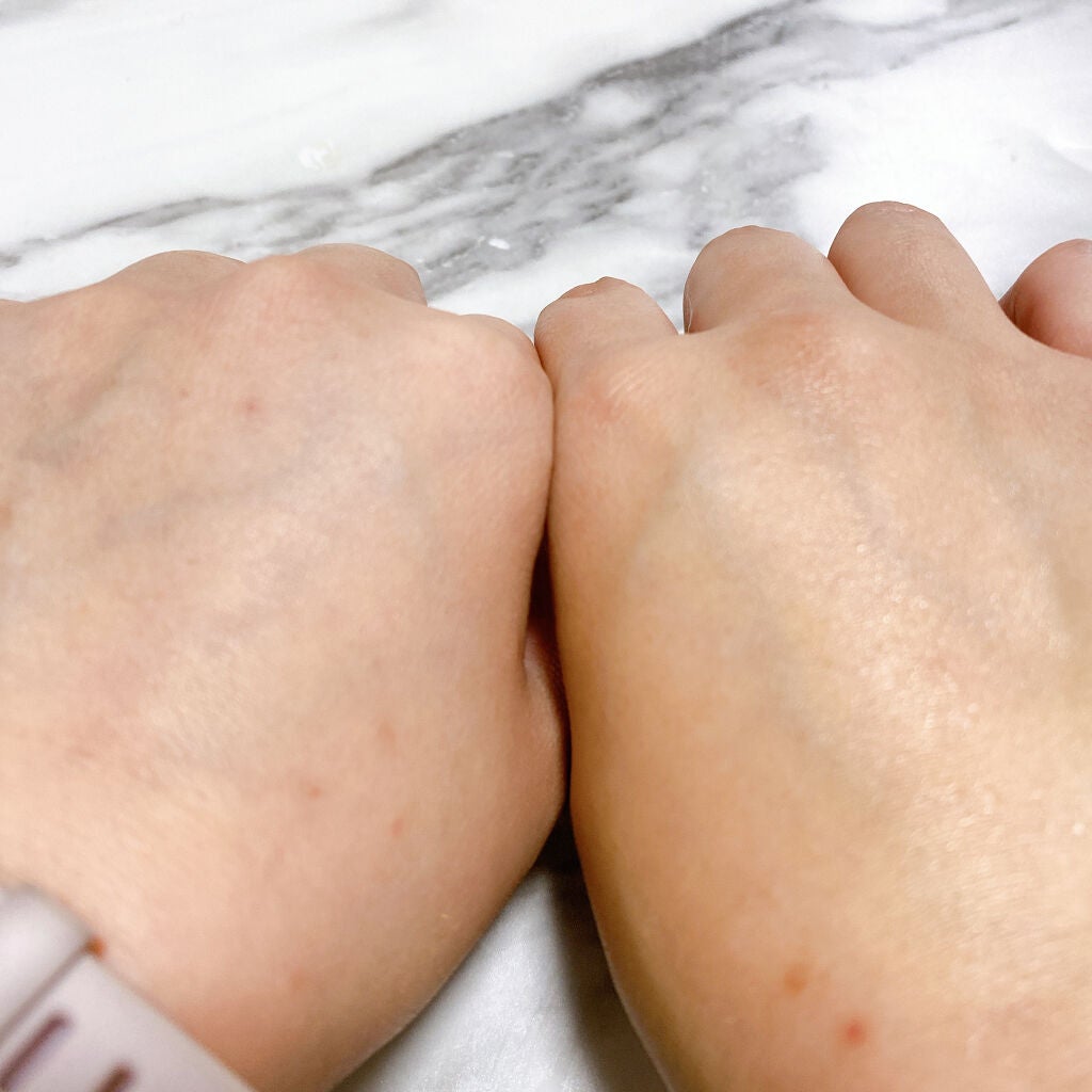 美容液化粧水/麗凍化粧品/化粧水を使ったクチコミ(7枚目)