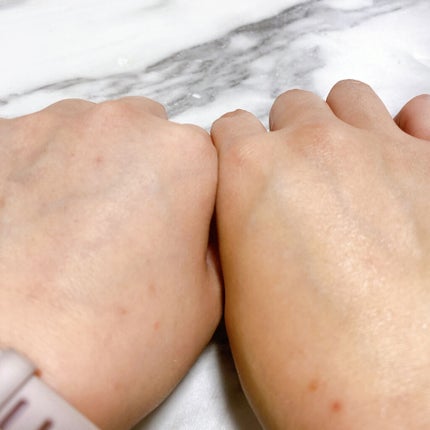 美容液化粧水/麗凍化粧品/化粧水を使ったクチコミ(7枚目)