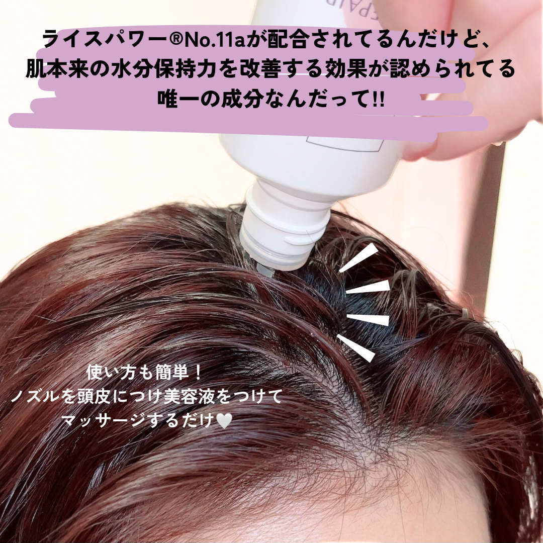 スカルプD ボーテ 薬用頭皮保湿美容液/アンファー(スカルプD)/頭皮ローションを使ったクチコミ（3枚目）