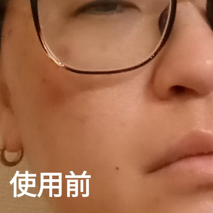 PDRNショット675/COSNORI/美容液を使ったクチコミ（3枚目）