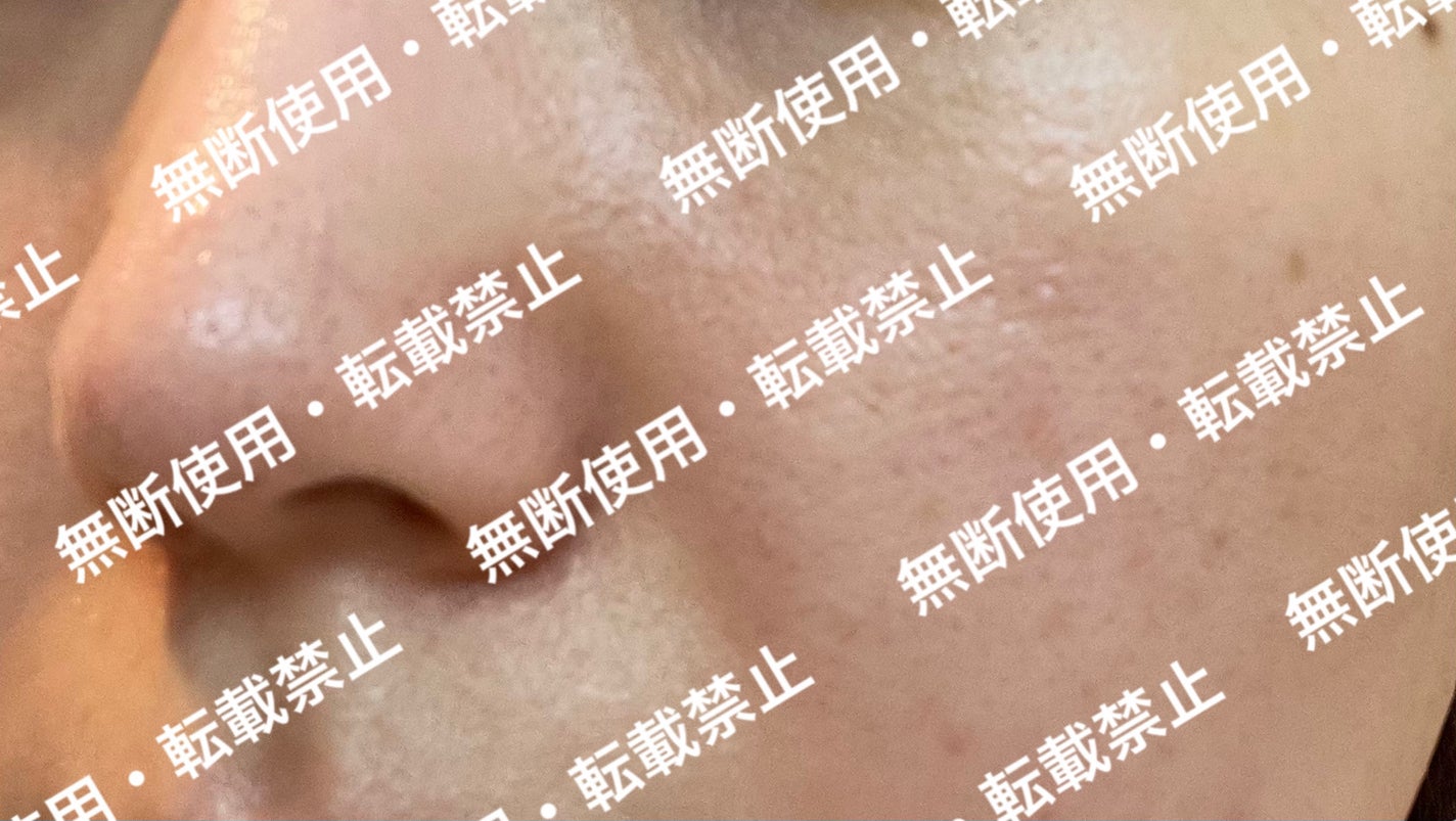 1番 さっぱりすっきりクレンジングオイル/numbuzin/オイルクレンジングを使ったクチコミ(4枚目)